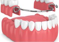 Bardgett Denture & Implant Solutions image 1